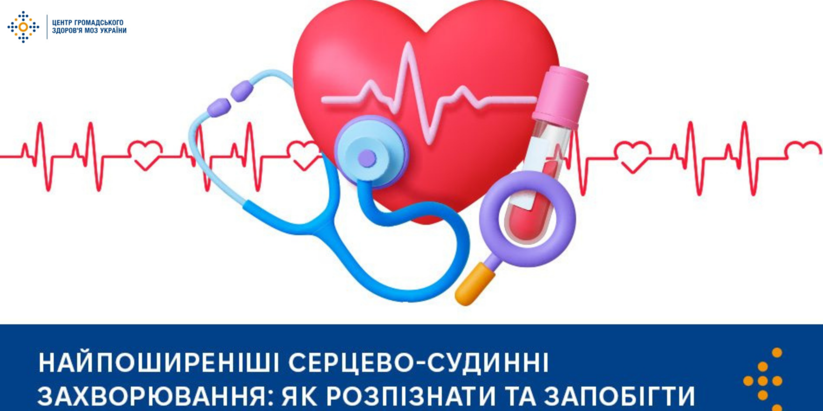 TSGZ-pro-sertse-1600x800