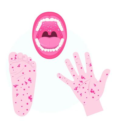 587187699_1163576259254099_6892396779542337817_n